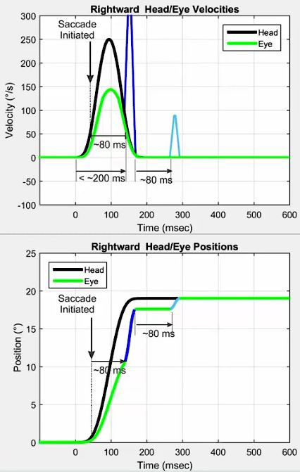 Graphiques de vitesse et de position. Dans le graphique de vitesse, les mouvements de la tête et des yeux sont tracés avec la vitesse, en degrés par seconde, en fonction du temps, en millisecondes. À 0 milliseconde, l'impulsion de la tête est initiée, avec une vitesse de pointe de la tête de 250 degrés par seconde. Au début, la vitesse de l'œil culmine à 150 degrés par seconde. Vers et pendant la fin de l'impulsion de la tête, un grand mouvement oculaire correctif est visible avec une vitesse de plus de 300 degrés par seconde. Une petite saccade manifeste est également visible 80 millisecondes après la fin de l'impulsion de la tête, avec une vitesse d'environ 90 degrés par seconde. Dans le graphique de position, les mouvements de la tête et des yeux sont tracés avec la position, en degrés, en fonction du temps, en millisecondes. À 0 milliseconde, l'impulsion de la tête est initiée, et la tête se déplace rapidement vers une position de 18 degrés. L'œil n'atteint que 12 degrés au début, suivi d'un mouvement oculaire immédiat et caché pour atteindre environ 17 degrés. Après 80 millisecondes supplémentaires, un dernier mouvement oculaire manifeste est effectué pour atteindre les 18 degrés.