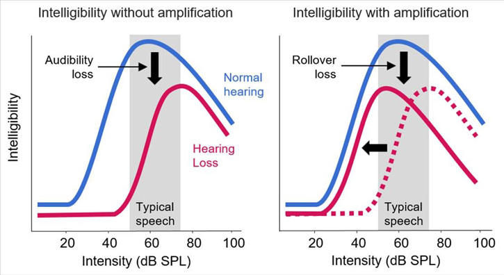 Unaided and aided graphs displaying speech intelligibility as a function of intensity in dB SPL. By providing amplification in this example, audibility loss is exchanged with rollover loss.