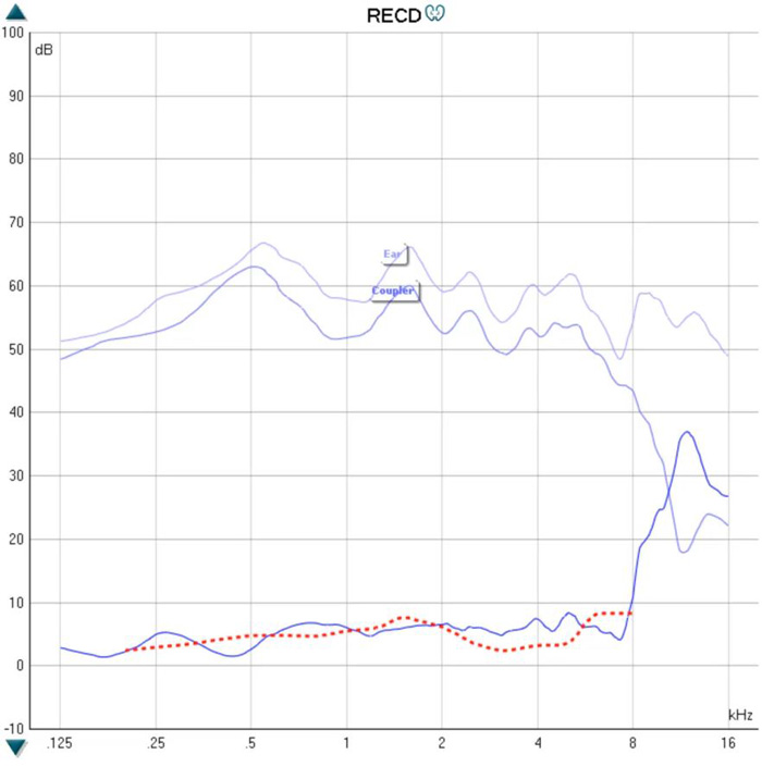 RECD graph with dB as a function of kHz. There are four curves on the graph. An ear graph, which hovers between 50 to 70 dB for all frequencies. A coupler graph, which is slightly below the ear graph until dipping heavily in the high frequencies. The RECD curve thus shows a small difference in dB until rising heavily in the high frequencies. The predicted RECD curve follows the measured RECD curve nicely for frequencies up to 8 kHz.