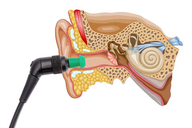 OAE and BERA ( otoacoustic emissions and brainstem evoked response  audiometry)