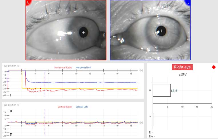 Eye tracking software displaying separate eye movement