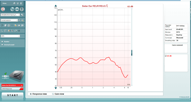Better Ear REUR/REUG measurement screen. Graph has dB SPL as a function of kHz. The curve hovers between 50-60 dB SPL in the 0.125-4 kHz range, after which it dips to lower intensities in the higher frequencies.