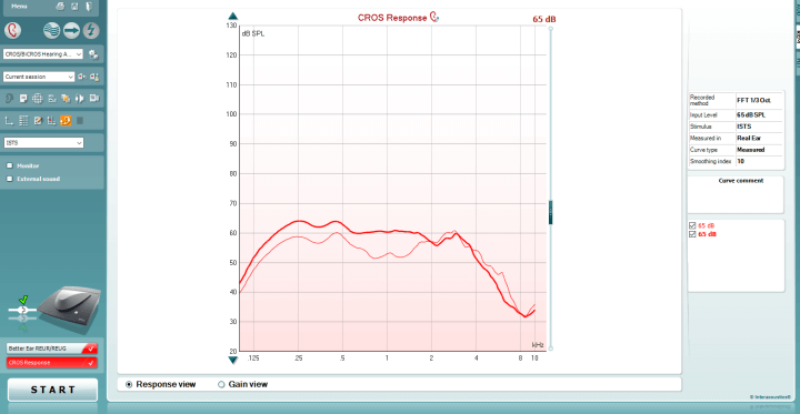 CROS Response measurement screen. Graph has dB SPL as a function of kHz. It shows the better ear REUR/REUG curve in faded red, while the CROS response curve is in bolded red. The better ear REUR/REUG curve hovers between 50-60 dB SPL in the 0.125-4 kHz range, after which it dips to lower intensities in the higher frequencies. The CROS response follows a similar pattern, but at slightly higher intensities in frequencies up to 2 kHz.