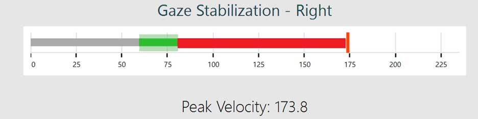 Gaze stabilization head velocity monitor. The target velocity is approximately 70 degrees per second. The peak velocity is 173.8, marked with a solid red line, which is to the right of a green shaded, correct range. The velocity bar between the correct range and the peak velocity is also red.