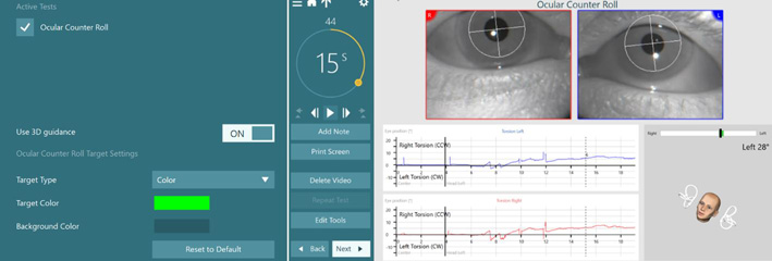 Real time 3d representation of the patient’s head. A black, solid line indicates the patient’s head angle, with a green shaded, correct region the head angle needs to reach. The head is in a correct, 30-degree angle toward the left.